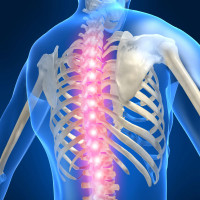 back-spine-osteoporosis-xray